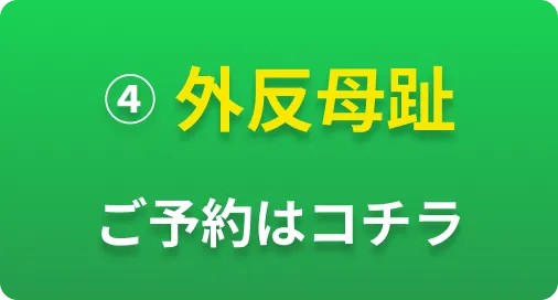 ④外反母趾 ご予約はコチラ